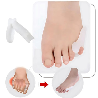 BunionGuard Exclusivo Quintus Varus | Separador de dedos para el dedo pequeño - Gel de protección contra juanetes - Corrección de deformidades - Alivio del dolor