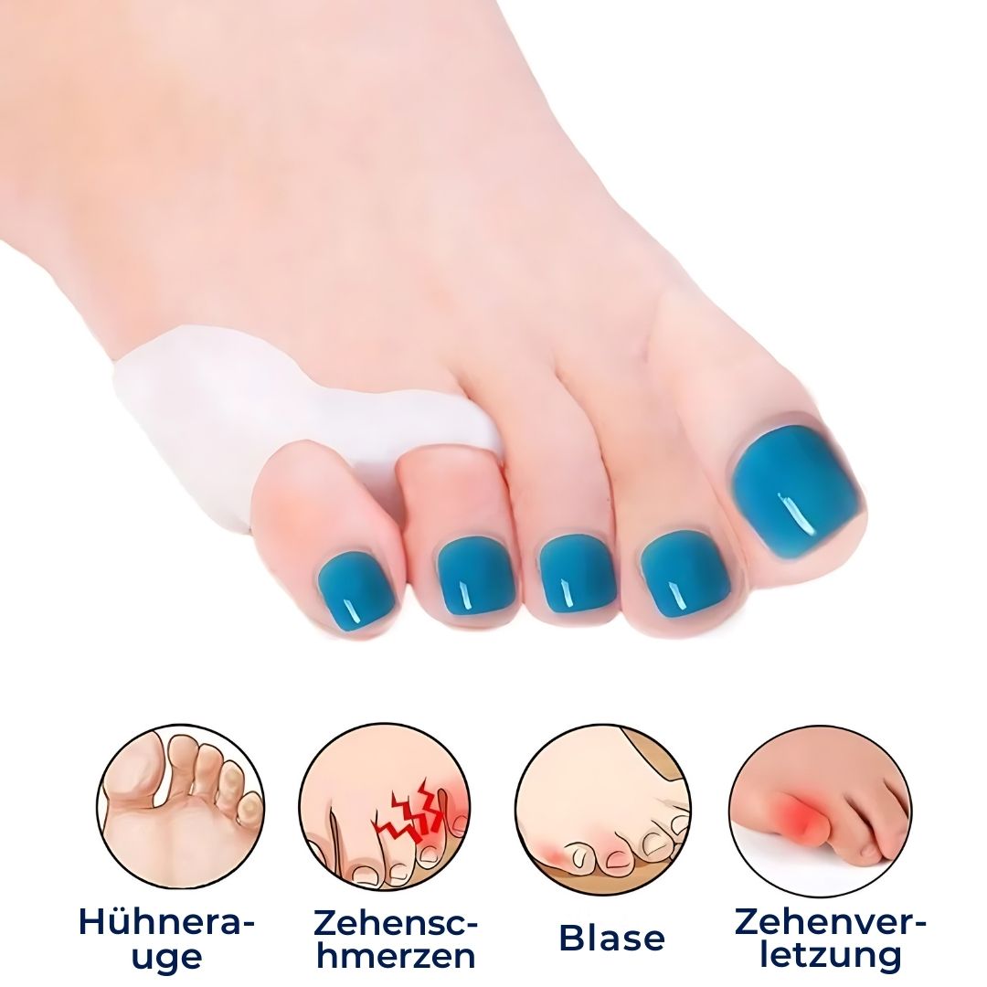 ToeGuard Exclusivo Separadores de Dedos Ortopédicos | Corrector de Bunionette para el Dedo Pequeño, Hallux Valgus, Dedos en Garra y Alineación de Dedos