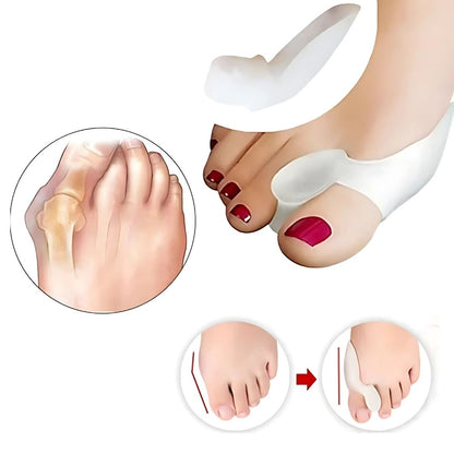 BunionGuard Exclusivo para Hallux Valgus | Protección de Silicona con Separador de Dedos – Alivio del Dolor y Ajuste Correctivo