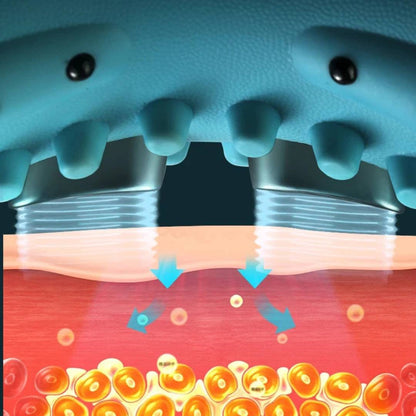NackenEase Exclusivo Dispositivo de Masaje de Cuello EMS – Alivio del Dolor – Estimulación Muscular – Función de Calor – Portátil para Tensiones