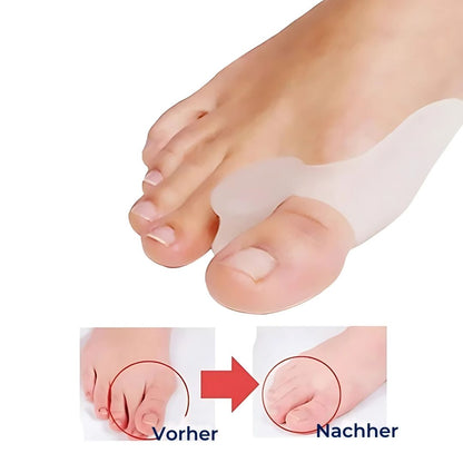 BunionGuard Exclusivo para Hallux Valgus | Protección de Silicona con Separador de Dedos – Alivio del Dolor y Ajuste Correctivo