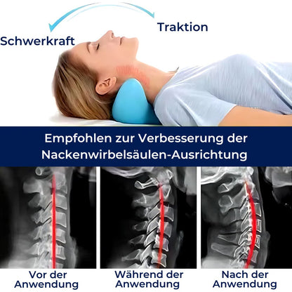 NeckAlign Exklusiv Almohada Cervical Quiropráctica | Estirador de Cuello para Alivio del Dolor, Mejora de la Postura y Mejor Sueño